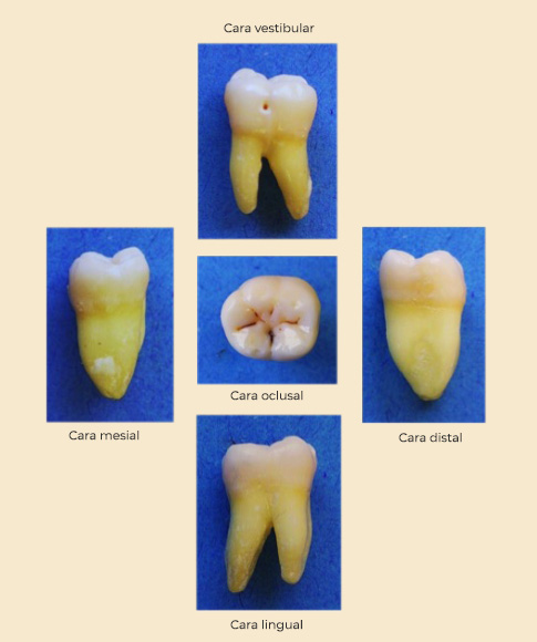 1.4.3 Primer molar inferior
